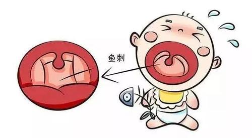 宝宝鱼-宝宝鱼刺卡在喉咙怎么办最有效的办法