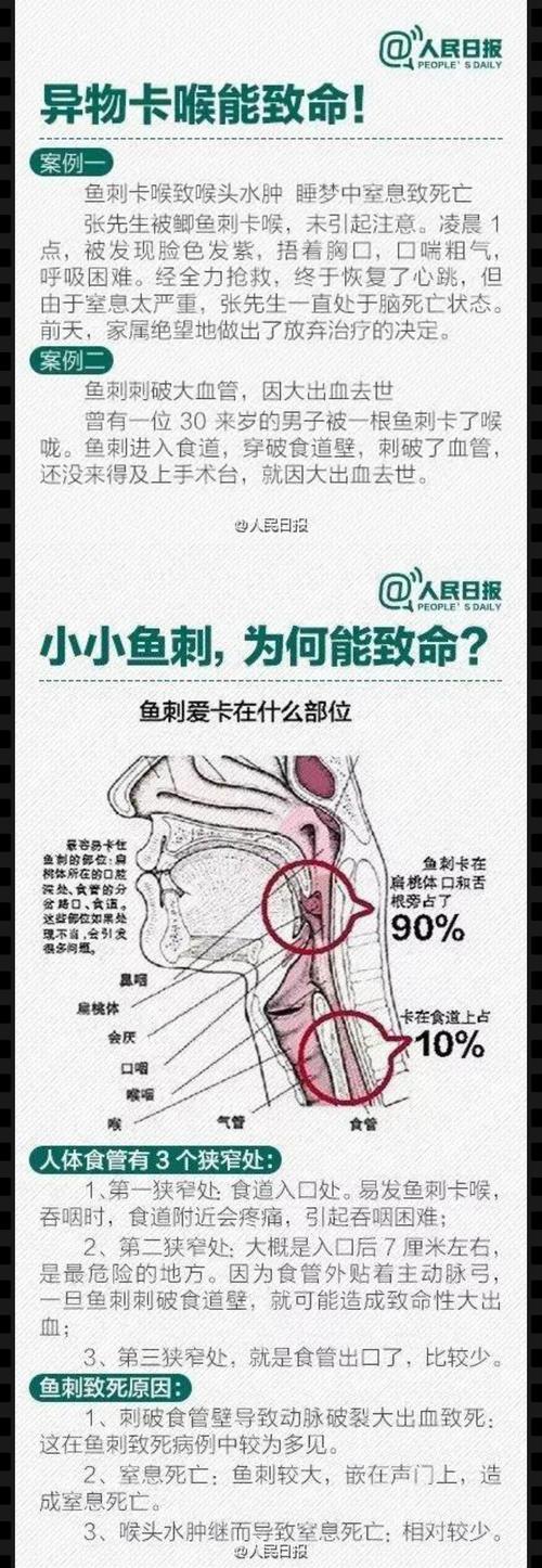 鱼骨头-鱼骨头卡到喉咙了怎么办
