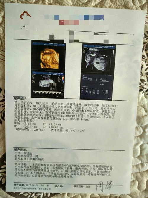 大排-大排畸多少周做最佳时间