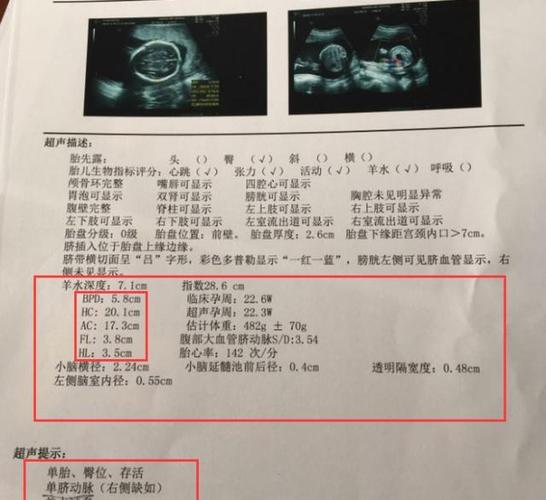 大排-大排畸和小排畸的区别是什么